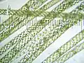 Spirogyra