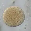 sporangium
