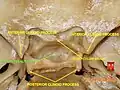 Base of skull - Sella turcica, tuberculum sellae and hypophyseal fossa