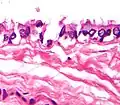 A very high magnification light micrograph shows a cilia of a bronchogenic cyst. H&E stain.