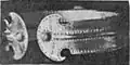 Boarta's very similar type found at Dalj (Slavonia)[79]