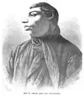 18-year-old Emil R., 1868
