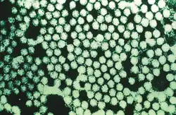 Electronmicrograph of Foot-and-mouth disease virus