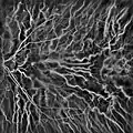 Laser Doppler imaging of retinal and choroidal blood flow