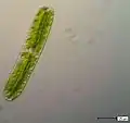 Netrium oblongum.&nbsp; A saccoderm "desmid"