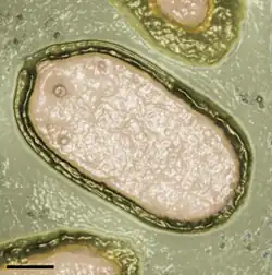Colorized electron micrograph of a pandoravirus