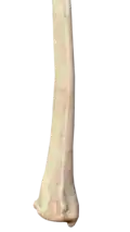 Posterior view of right distal radius