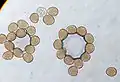 Urediniospores of a rust fungus