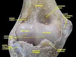 Elbow joint - deep dissection (anterior view, human cadaver)