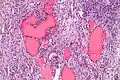 Higher magnification