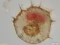 Centropyxis aculeata